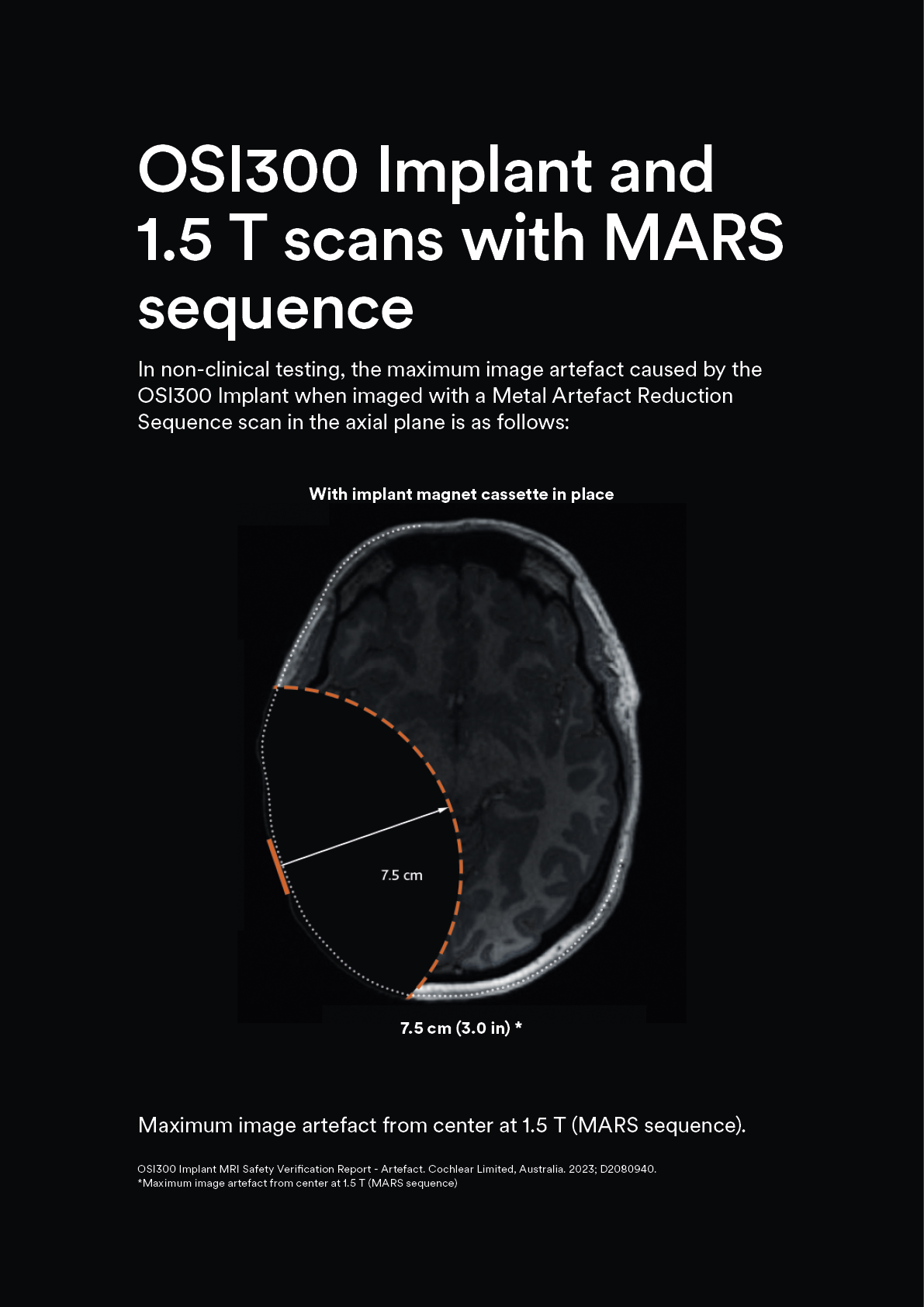 1_1.5T_MARS_7.5