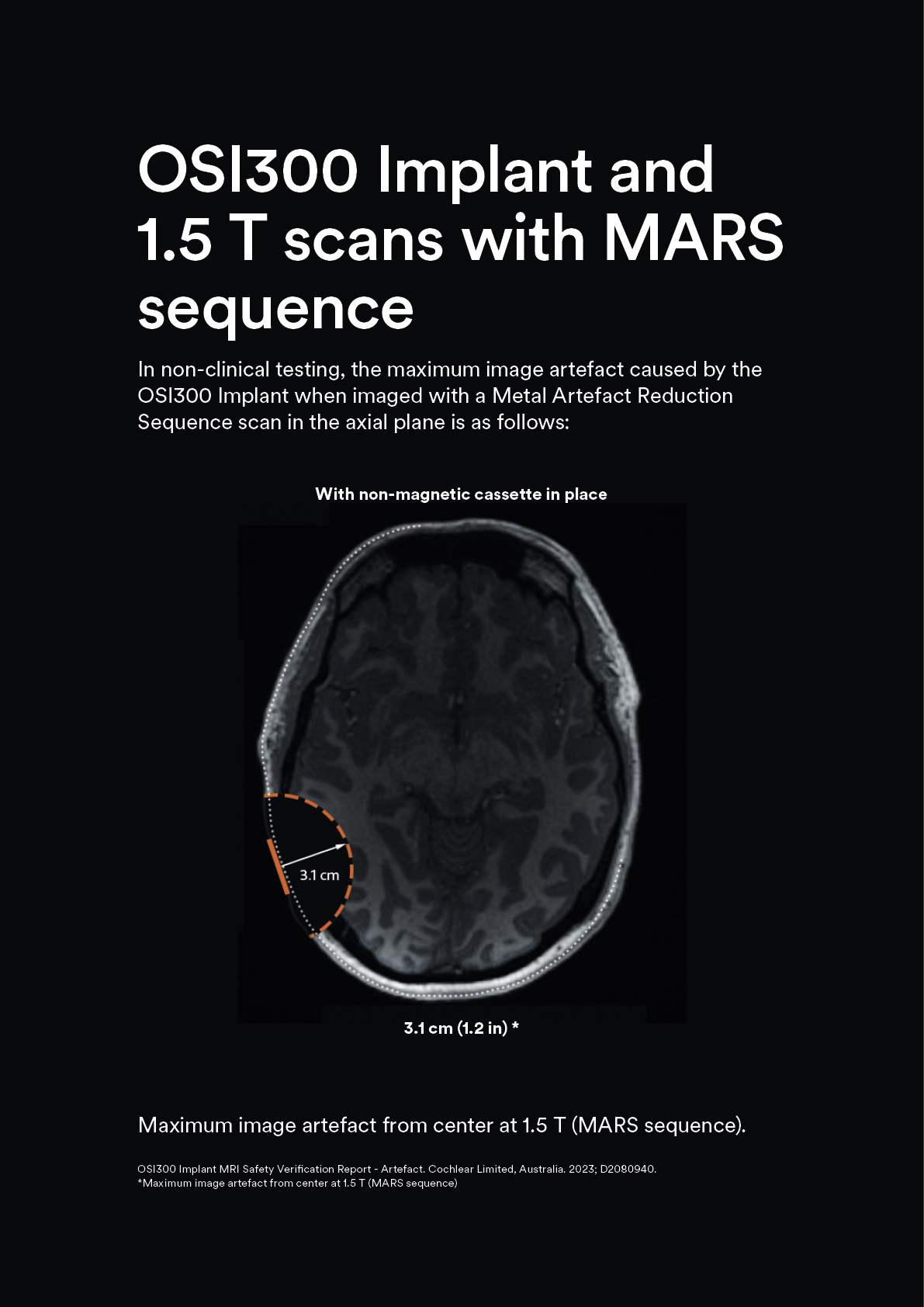 2_1.5T_MARS_3.1