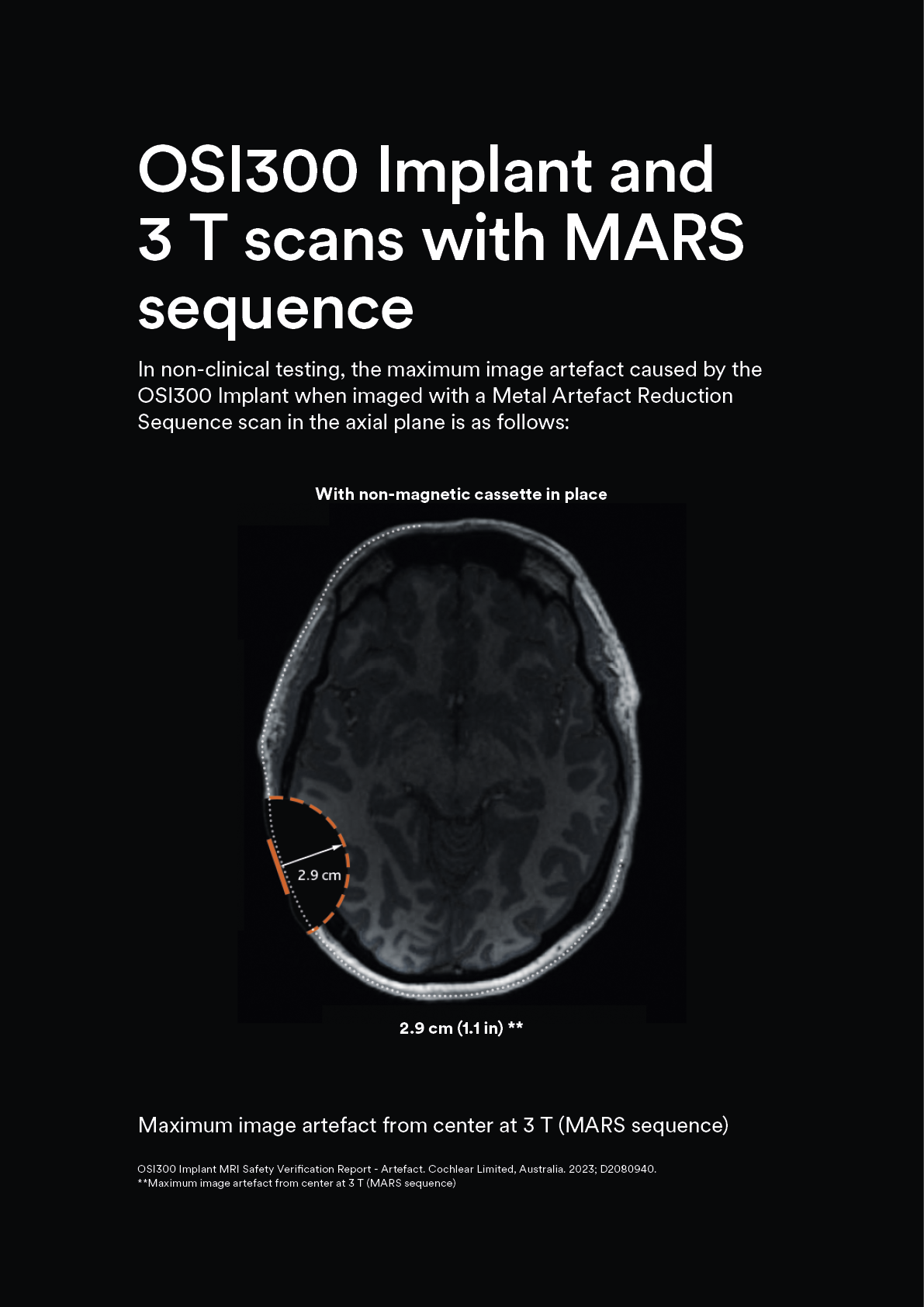 8_3T_MARS_2.9