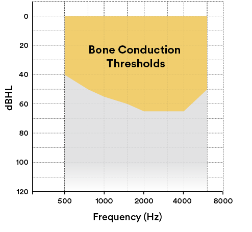 A graph shows the frequency of bone conduction thresholds. AI generated content