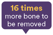 16 times,more bone to be remove