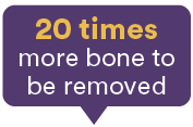 20 times,more bone to be remove
